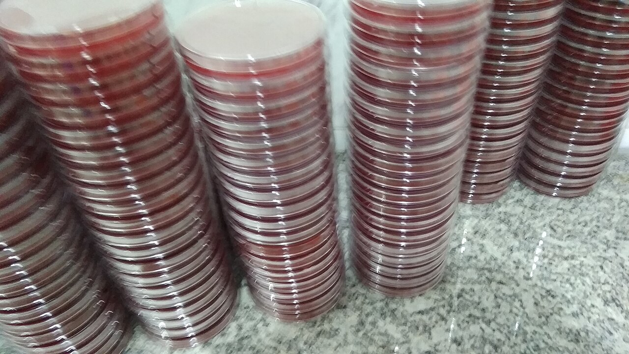 Stacks of blood agar plates on a clinical microbiology bench